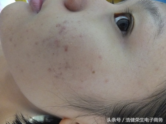 不要小看这些症状,不要小看你的疾病