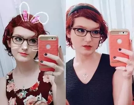 男人服用大量雄性激素会怎么样,男生长期服用雌性激素会怎么样