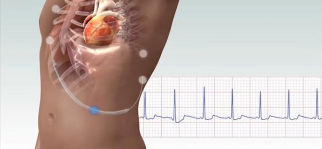 海思科投资价值,海思科未来5年投资价值