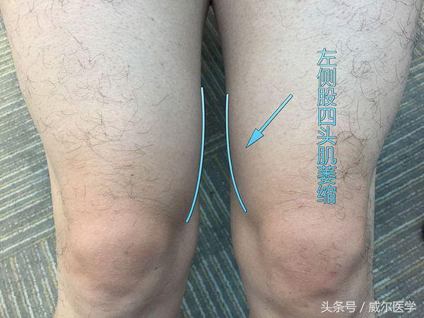 吃药不管用是吸收不好吗,吃药不管用怎么恢复