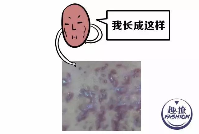 angelababy痘痘,angelababy额头冒巨痘