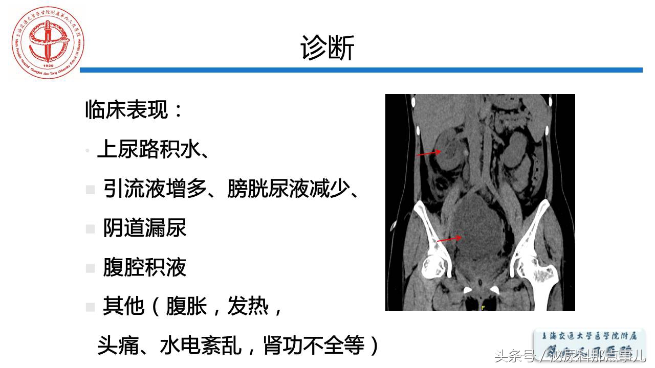 泌尿男科王忠教授,泌尿外科专家王忠教授