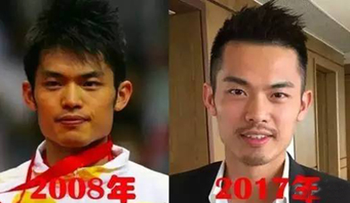 微整形安全还是危险,微整形值得做吗