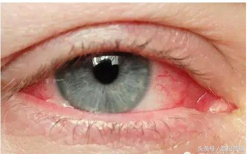 狗红眼病的症状和治疗方法,红眼病的引发原因