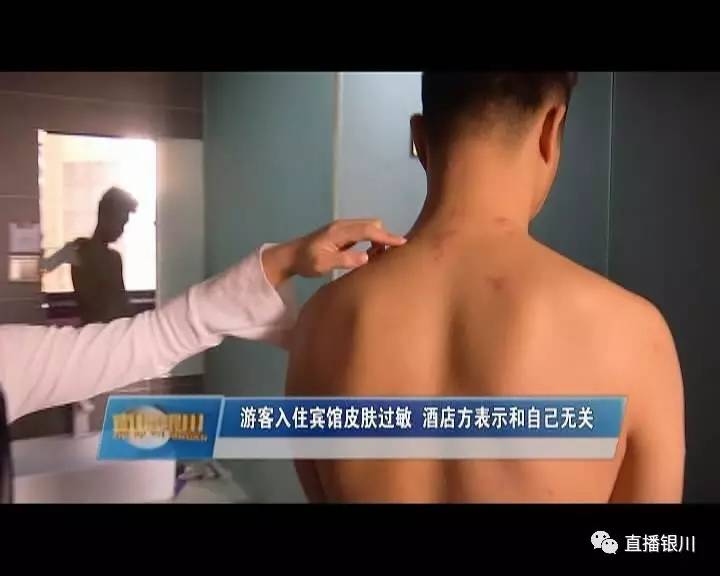 睡酒店的床过敏怎么维权,睡酒店起一身疙瘩怎么维权
