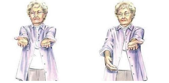 脑血栓的前兆怎么治最有效,出现脑血栓征兆如何缓解