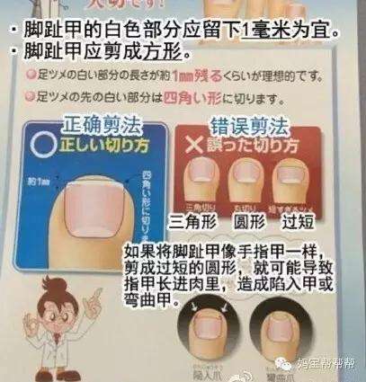 嵌甲型甲沟炎用什么药膏可以治好,治疗嵌甲甲沟炎有效的方法