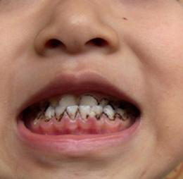 宝宝为什么喜欢张大嘴笑,小宝宝为啥抿着嘴笑