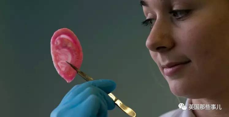 在苹果片上“种”出人耳？！这不是恐怖故事，是脑洞大开的医学新方向啊喂！