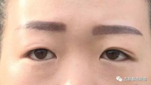 长春女子在中东七彩城金马国际高温瑜珈馆做双眼皮出问题一查竟无微整形项目营业资质