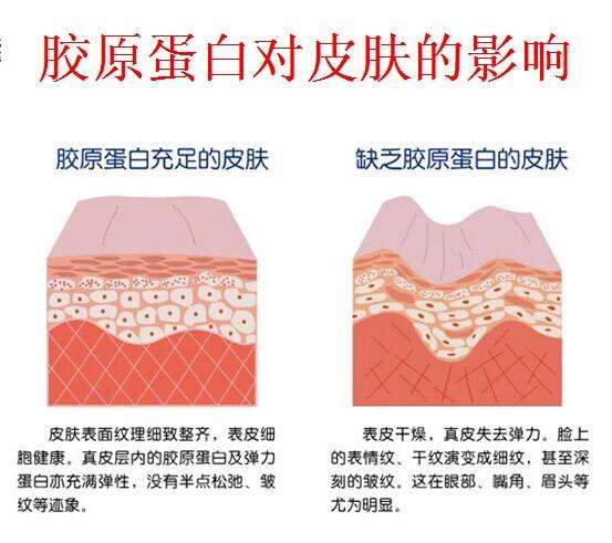 超声刀需要修复吗,超声刀失败怎样修复