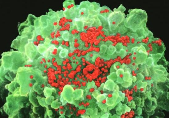 艾丝病患者你们有救了，这真是“振奋人心”的消息