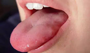 9个症状说明你“湿气”重，尤其第四个，再不注意你麻烦就大了