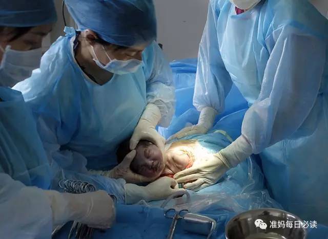 剖宫产的医学指征，出现这些状况，准妈只能剖腹产了！