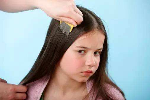 针对干枯头发的护发产品,头发可以顺直的护发产品