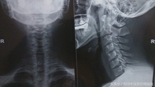 头晕头痛一年了都不知道什么病,头晕七年