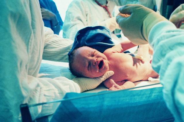 分娩时为什么要“侧切”?99%的准妈妈不知道其中的关键!