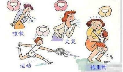 kegel女性训练,kegel训练男性