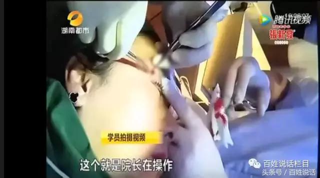 微整形乱象的解决对策,非法行医微整形纠纷