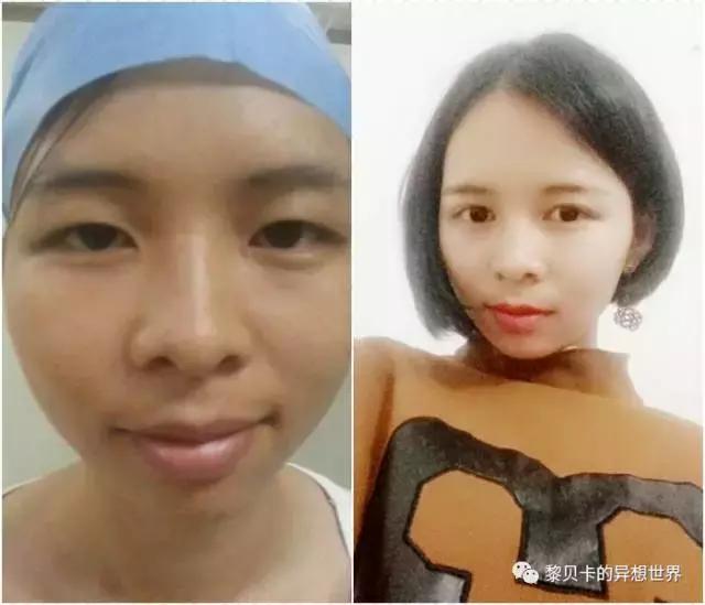 减肥变美的教程,变美最好的方法是减肥