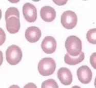 外周血细胞涂片的正常值,外周血细胞分析多长时间出结果