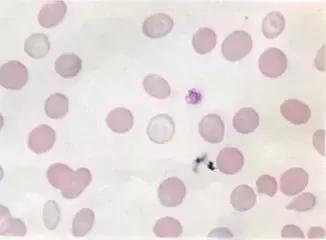 外周血细胞涂片的正常值,外周血细胞分析多长时间出结果