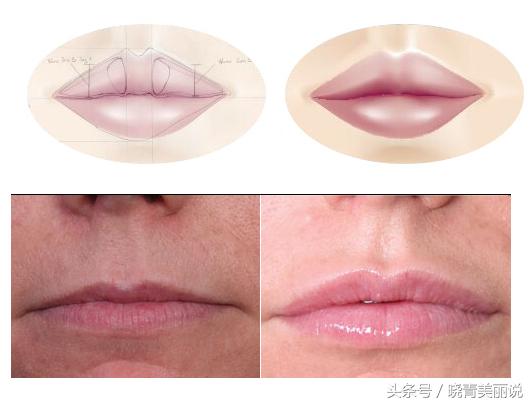 李小璐吐槽大会说贾乃亮,李小璐丰唇