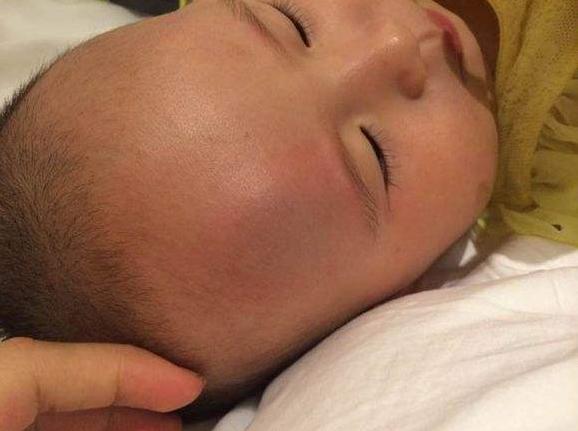 摔肿了可以揉吗,宝宝摔着头怎么消肿