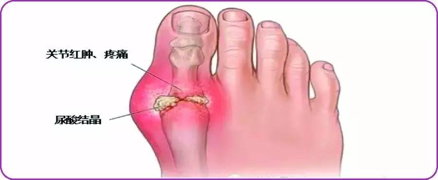 90%的腰痛都没必要拍片,腿疼看医生视频