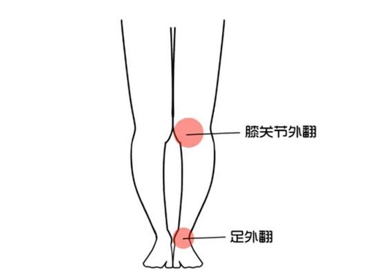 大腿和小腿不在一条线怎么矫正,腿型不好看怎么矫正直腿