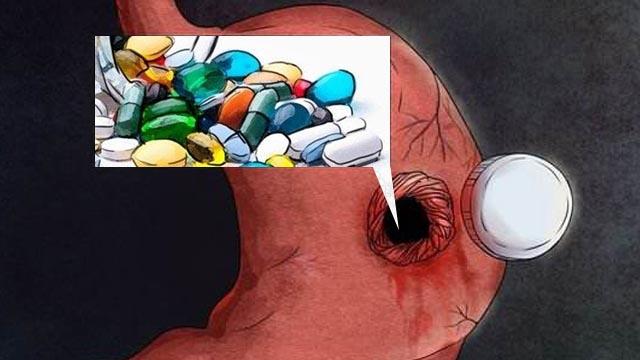 治疗消化性溃疡的药物机制,中医消化性溃疡诊疗指南