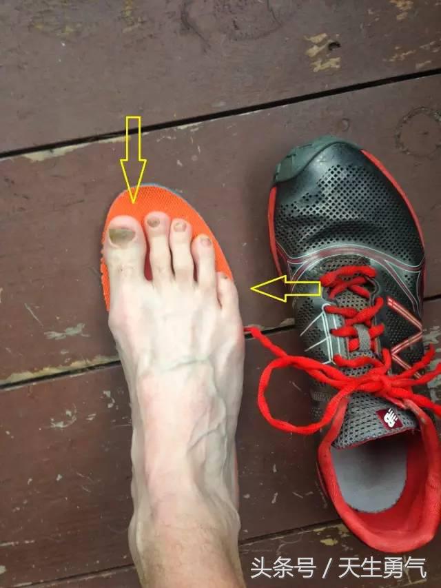 跑鞋买正好还是稍微大一码好,跑鞋应该刚好合适还是买大一点