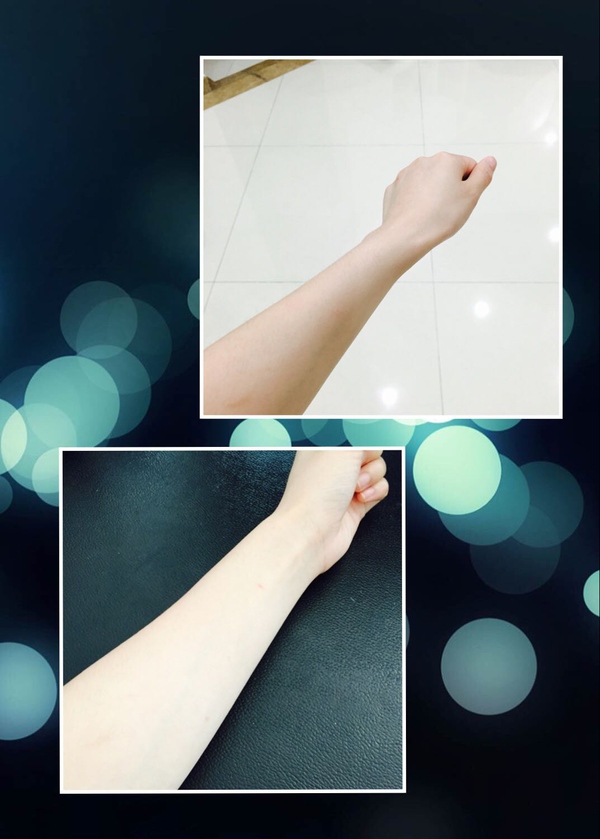 打美白针的风险？美白针是非法的！