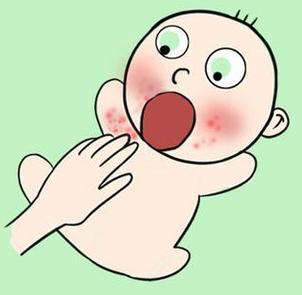 最全湿疹日常护理攻略,宝宝夏天屁屁长湿疹一招搞定