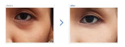 黑眼圈折磨我这么久，今天该认真聊聊了