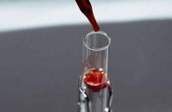 宁波郭女士的血好奇怪！温度低于31℃会凝固高于37℃化开！输血整整6小时，医生动破脑筋……