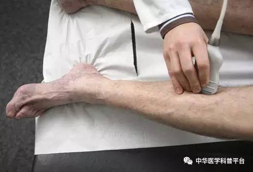 长血栓吃什么药最好,长血栓