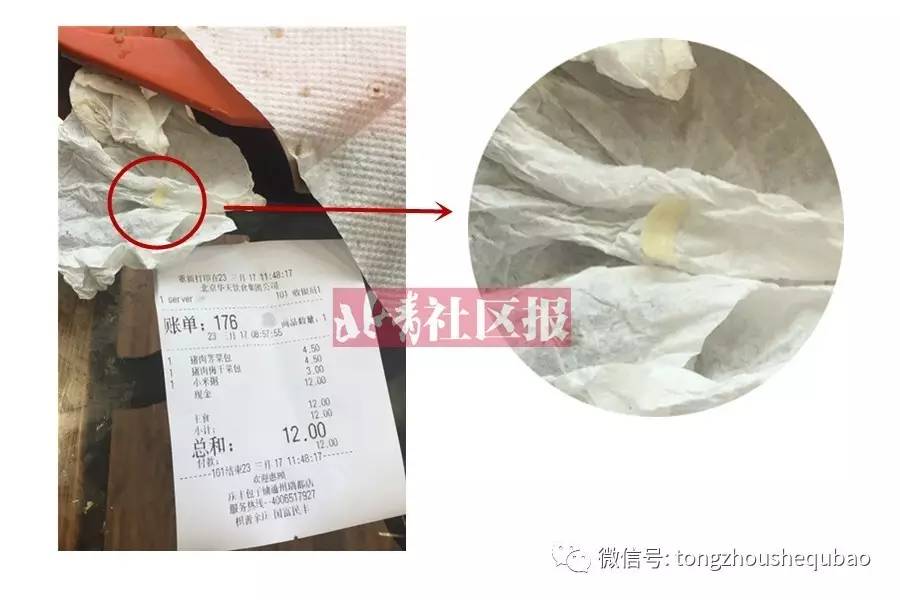 怒了！通州梨园一家庆丰包子铺吃出一截指甲！