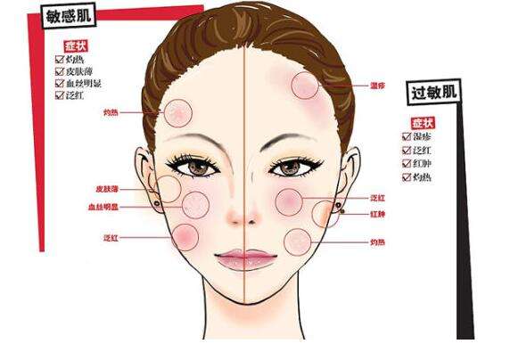 过敏体质者应该怎么来改善