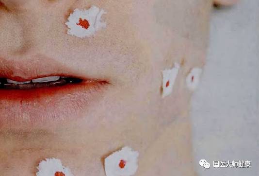 突然长出来的痣要切吗,乳房突然长痣会癌变吗