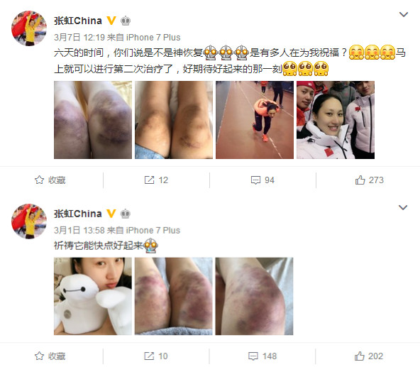 运动员的背后你知多少?训练练到双膝红肿淤青,甚至脚趾盖磨掉!