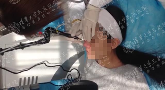 最近脸上疯狂长痘是因为换季吗,一换季脸就起痘