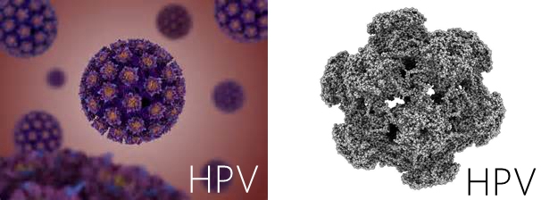 宫颈高度病变镜下观察,宫颈镜下可疑浸润癌严重吗