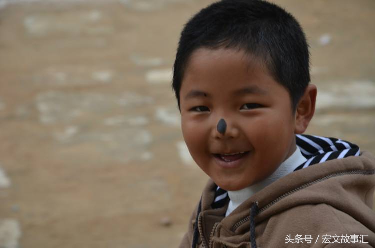 小孩擦鼻子鼻子下边黑了一小片,帮忙给小孩子擦鼻子