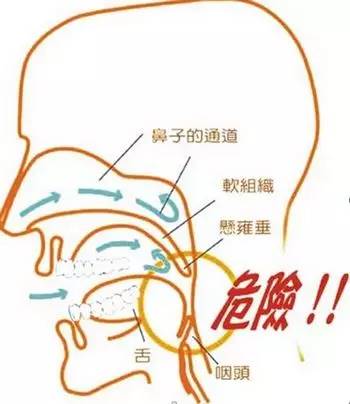 男子因打鼾呼吸暂停而死亡,男人喝醉酒打呼噜憋气视频