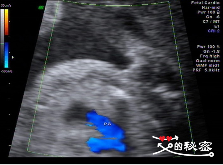 四维空间神秘事件,揭秘四维的存在