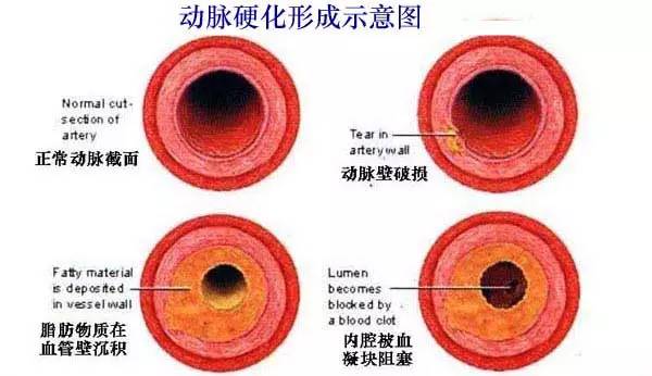 人头晕怎么办才能治好,人头晕沉沉怎么办