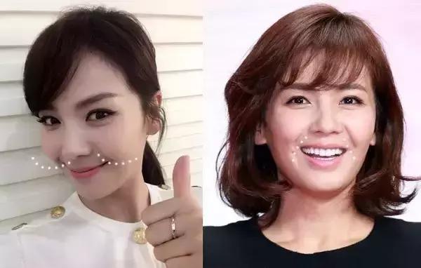 爱美的你一定要知道的小妙招,爱美的你可要多注意啦