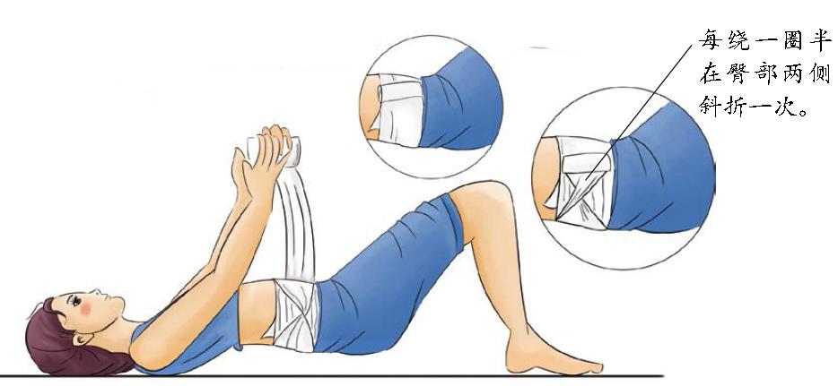 祛妊娠纹的凝胶产后多久开始抹,产后祛除妊娠纹有哪些方法