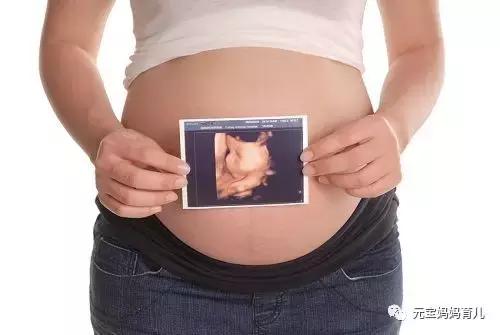 四维彩超检查什么？做这个目的主要是什么？